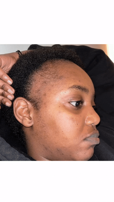 Close-up profile of a person with short curly hair and visible hair thinning near the temple, resting head on hand
